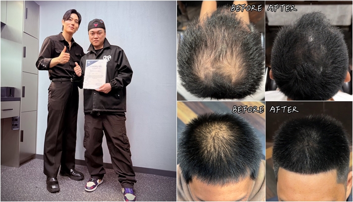 全台唯一引進！最新韓式頭皮彩繪 Scalp Painting，頭髮濃密的黑魔法！ @海綿飽飽的鳳梨城堡